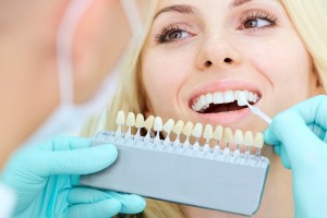 matching tooth color