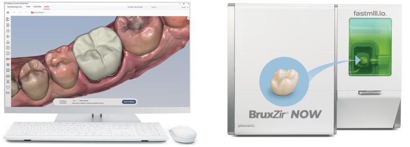 Example scan and device of Same-Day Glidewell Fastmill.io Crowns
